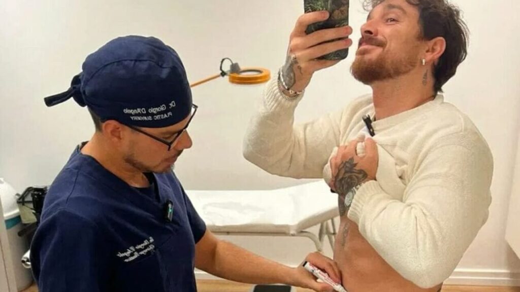 Andrea Cerioli svela la sua scelta di liposuzione per superare il disagio in costume