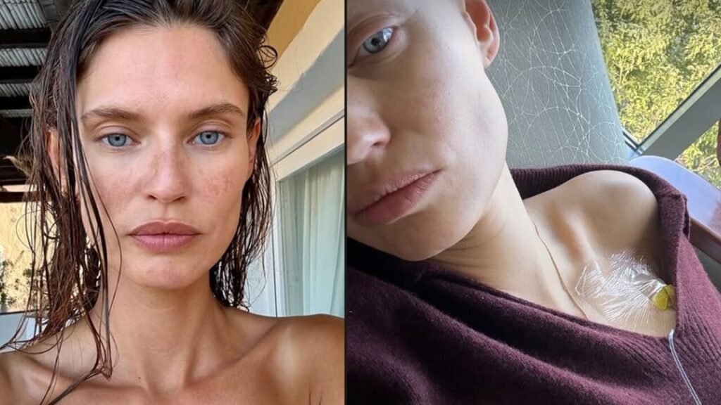 Bianca Balti affronta la chemio con coraggio e condivide momenti di speranza